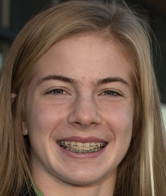 Peyton Schieppe, O'Fallon
